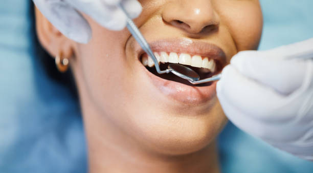 Best Emergency Dentist for Lost Fillings or Crowns in Washington Terrace, UT
